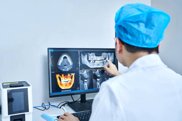 Best Emergency Wisdom Tooth Extraction in Bishop, TX